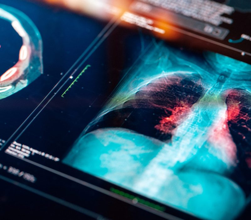 64a2ae1c8b12e7dccaaec7f5_tidalsense case study 64a2ae1c8b12e7dccaaec7f5_tidalsense case study
